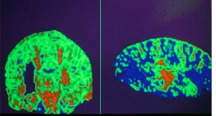 MRI of human brain experiencing naughty thoughts.